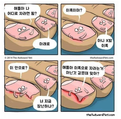 내성발톱 썰 ㅋㅋㅋㅋ